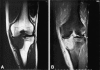 Fig. 2A–B