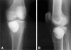 Fig. 3A–B