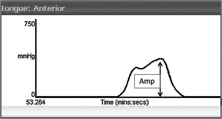 Fig. 2