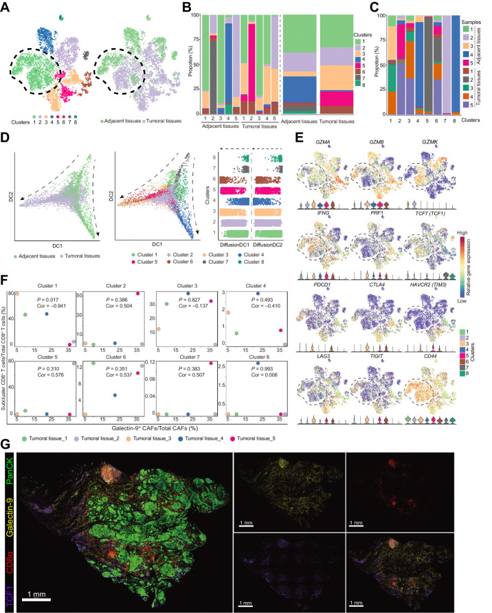 Figure 6. TCF1+GZMK+CD8+ T cells were negatively correlated with galectin-9+ CAFs. A, t-SNE plots of single-cell RNA sequencing result for the CD8+ T cells from the previous 5 paired tumoral and adjacent normal tissues. Cells were clustered into 8 populations (left) and origins (right) are also indicated in the t-SNE plots. B, Bar plots show cluster proportions in tumoral and adjacent tissues (left) and cluster proportions (right) in each sample. C, Bar plots show sample fraction in each cluster. D, Pseudotime analysis of CD8+ T cells by “DiffusionMap” algorithm. Cells were labeled by tissue origins (left) or clusters (middle). Right, the top two major diffusion compounds distribution of cells from different clusters. Arrows, differentiation directions. E, Regression analysis of the fraction of galectin-9+ CAFs in total CAFs and the fraction of eight clusters of CD8+ T cells from the 5 tumoral tissues. F, Expression of genes defining cytotoxic functions (GZMA, GZMB, GZMK, IFNG, and PRF1) and status (TCF1, PDCD1, CTLA4, HAVCR2, LAG3, and TIGIT) of CD8+ T cells and the genes coding the receptors of galectin-9 (CD44, HAVCR2) in the 8 clusters of CD8+ T cells. G, Representative immunofluorescence results of human HNSCC tumor samples stained for PanCK (green), galectin-9 (yellow), CD8α (red), and TCF1 (purple). Scale bar, 1 mm.