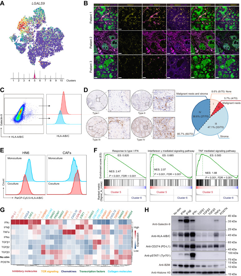 Figure 5. The immune checkpoint ligand molecule, galectin-9, was enriched in cluster 5 of CAFs. A, The t-SNE result of fibroblasts overlaid with LGALS9 (the gene encoding galectin-9). B, Representative immunofluorescence results of human HNSCC tumor samples stained for pan-cytokeratin (PanCK; green), αSMA (wine), galectin-9 (yellow), HLA-A/B/C (purple). Scale bar, 80 μm. C, Galectin-9 and HLA-A/B/C expressions in CAFs from human HNSCC tumor samples. The gating strategy for CAFs is presented in Supplementary Fig. S7C. D, Left, representative images of HNSCC tissue chip for different distribution patterns of galectin-9. Scale bar, 200 μm. Right, the proportions for four types of galectin-9 distribution are also summarized. E, Flow cytometry of HLA-A/B/C expression for monocultured or cocultured HN6 and CAFs. F, GSEA for cytokines-associated pathway enrichment of differentially expressed genes between clusters 5 and 6 CAFs. G and H, Gene expressions in CAFs treated with different cytokines (IFNα, IFNβ, IFNγ, TGFβ1, TGFβ2, TGFβ3, TNFα, and POSTN; the concentration of cytokines was 100 ng/mL). G, CAFs treated with cytokines for 24 hours were harvested for mRNA isolation and qRT-PCR. The data were pooled from three independent experiments and the relative expressions of targeted genes were analyzed relative to GAPDH or ACTB. H, CAFs treated with cytokines for 48 hours were harvested for Western blotting.