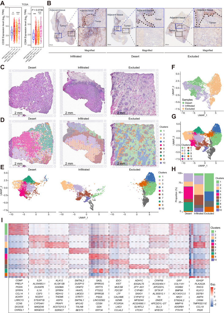 Figure 1. CD8α+ cells were maintained in the stroma of all three immune types of HNSCC. A, The CD8A and CD3E expression results of HNSCC bulk RNA sequencing data from TCGA database. The results are displayed in range and mean ± SEM, and statistics are accessed by the Wilcoxon test. *, P < 0.05; ***, P < 0.001. B, IHC staining of CD8α of the infiltrated, desert, and excluded immune type of HNSCC. Representative sites for the margins of tumor invasion and the tumor beds are labeled with dark blue and black rectangles, respectively, and magnified. C and D, H&E staining and spatial distribution of different clusters for spots throughout the tumor (with adjacent) tissues in the 10x Visium capture slides from desert, infiltrated, and excluded immune-subtype specimens. E–G, UMAP distribution of spots captured with the 10x Visium capture slides from desert, infiltrated, and excluded immune-subtype specimens. E, The captured spots are split by sample origins and labeled according to clusters. The spots are also summarized and labeled according to different immune-subtype specimens (F) and clusters (G). H, Proportion of the spots of different clusters in each immune-subtype specimen. I, Heat map of top markers for each cluster of spatial spots. The top 10 genes are listed. The rank of the gene markers was accessed with “findmarker” algorithm.