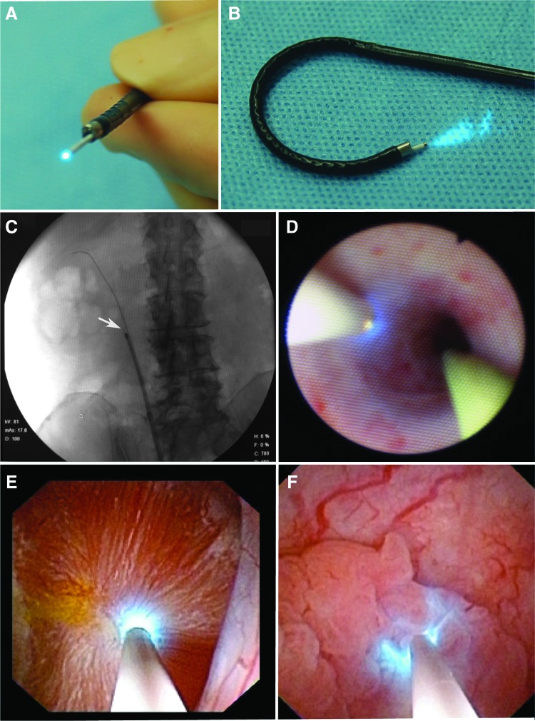 FIG. 1.