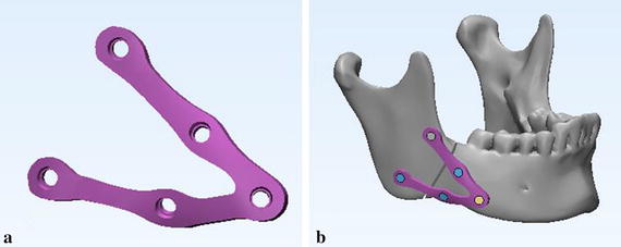 Fig. 10