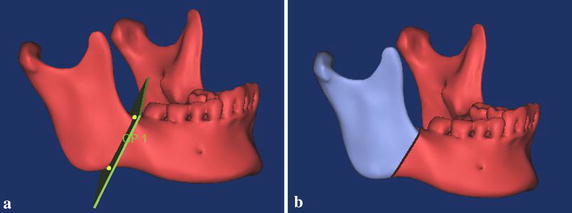 Fig. 2