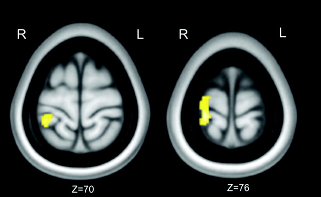 Fig 2.