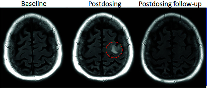 FIG 1.