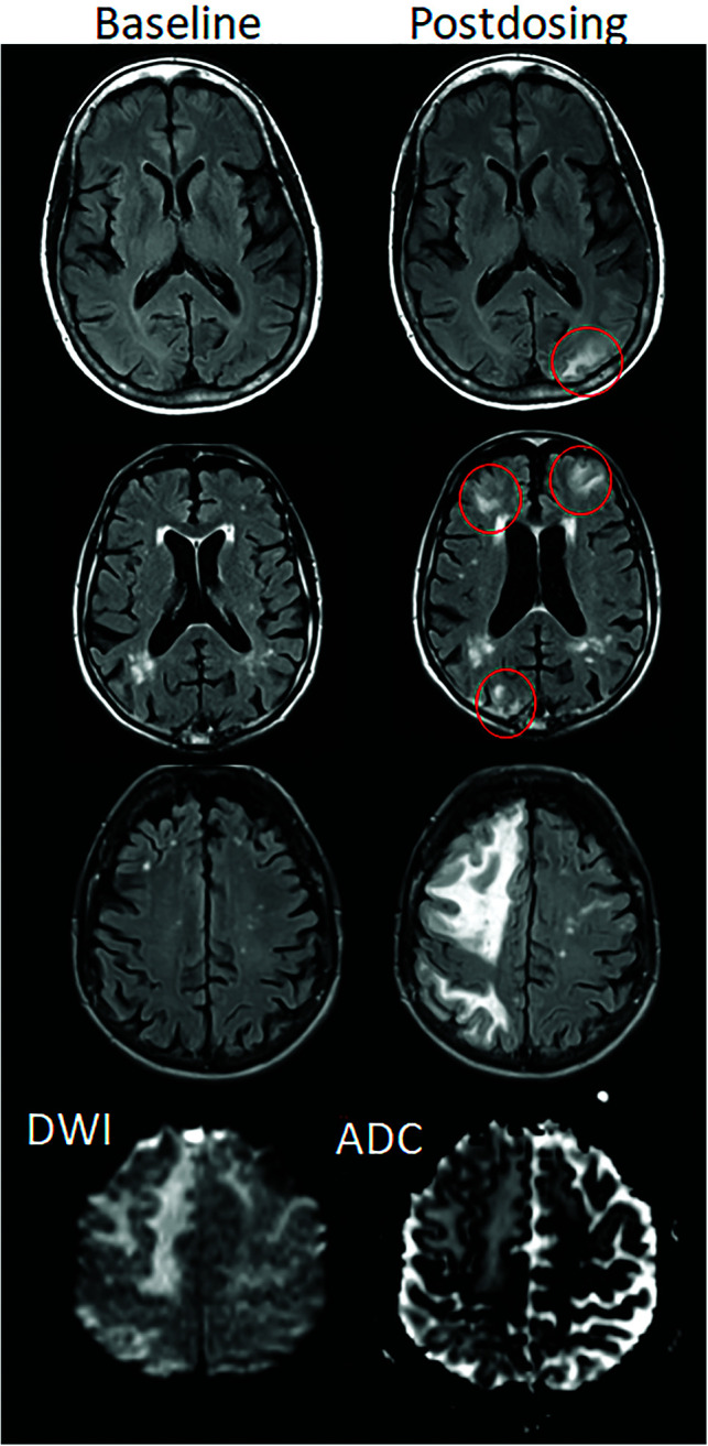 FIG 2.