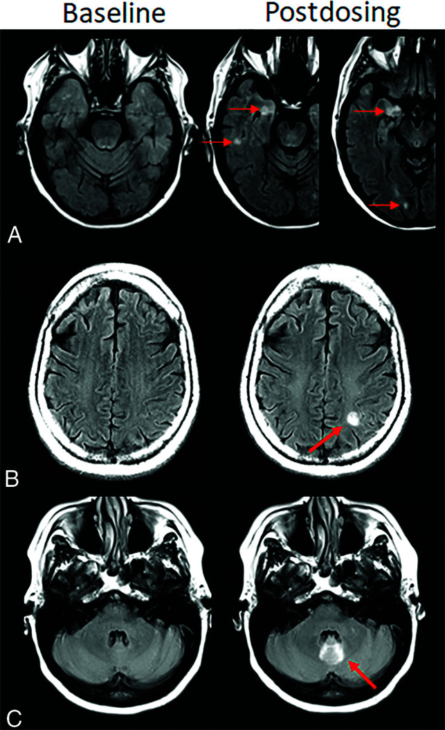 FIG 4.