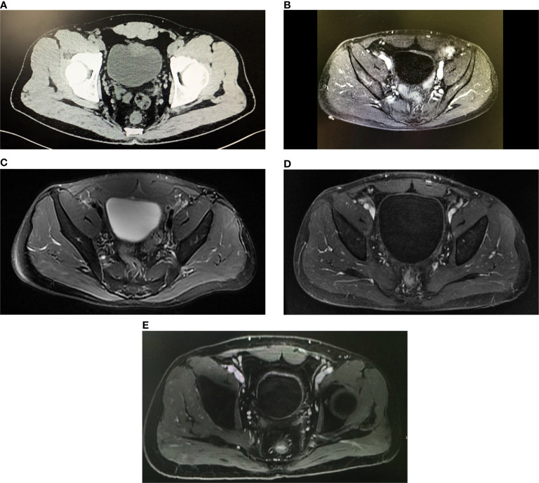 Figure 1