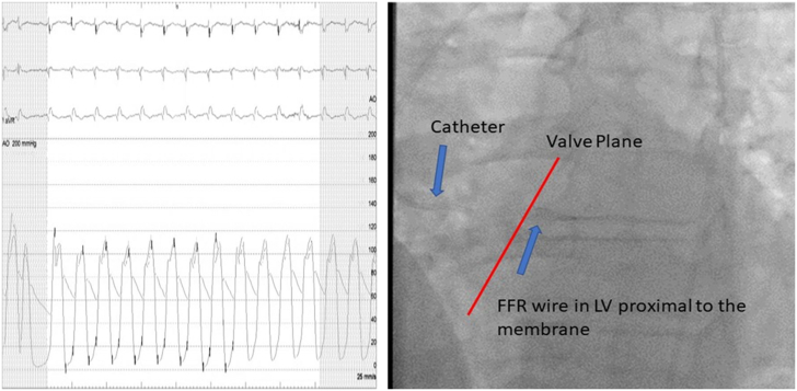 Figure 6