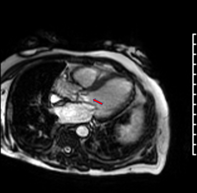 Figure 3