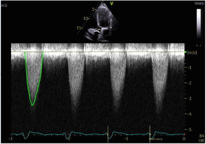 Figure 2