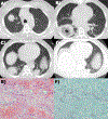 Fig 2.