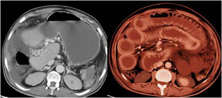 Fig. 2