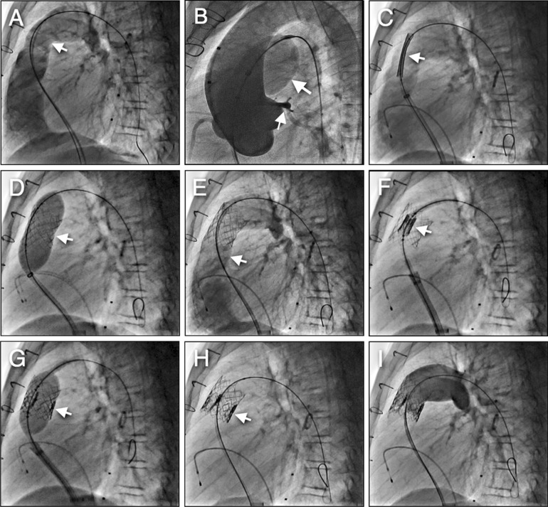 Fig. 3