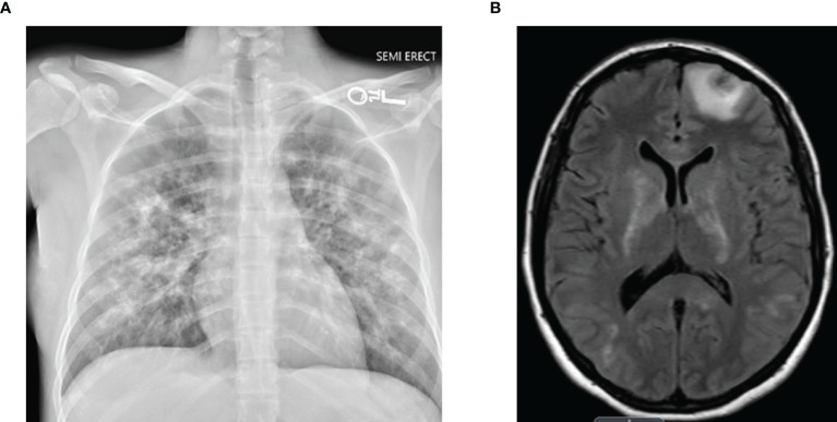 Figure 1