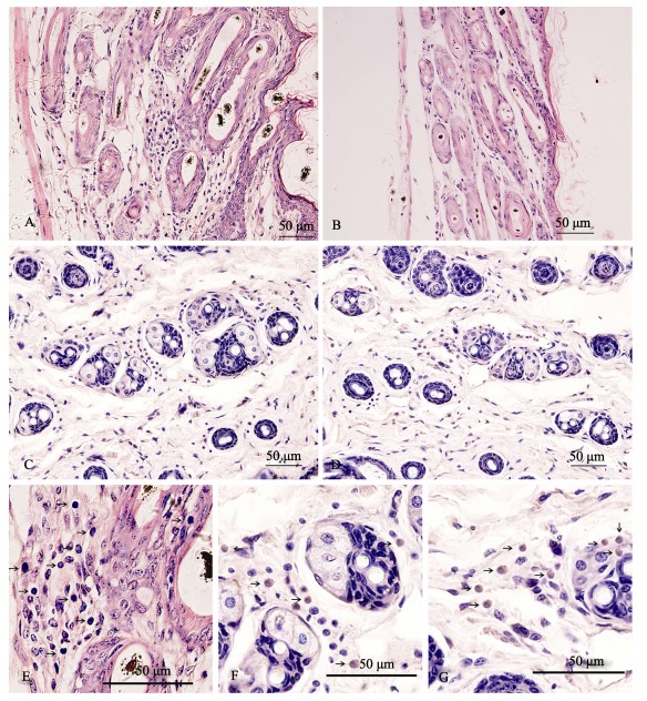 A, E: Dorsal skin of 8-week-old B6.KM<italic>-AA</italic> mice, HE staining, lymphocyte infiltrations could be seen peri- and intra- hair follicles; B: Dorsal skin of 8-week-old B6 mice, HE staining, no lymphocytes infiltrations could be seen around hair follicles; C, F: CD4<sup>+</sup> immunohistochemistry staining of the dorsal skin of 8-week-old B6.KM<italic>-AA</italic> mice, yellow-brown positive CD4<sup>+</sup> T-lymphocytes could be seen around hair follicles; D, G: CD8<sup>+</sup> immunohistochemistry staining of the dorsal skin of 8-week-old B6.KM<italic>-AA</italic> mice, yellow-brown positive CD8<sup>+</sup> T-lymphocytes could be seen around and inside of hair follicles.