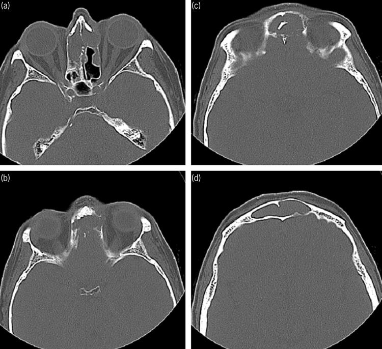 Figure 2 