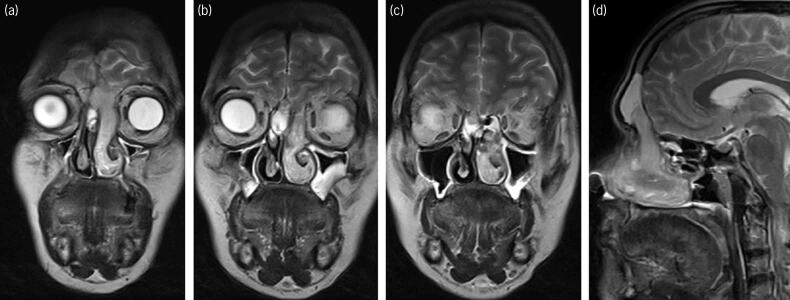 Figure 3 