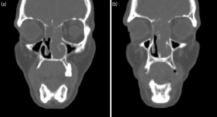 Figure 1 