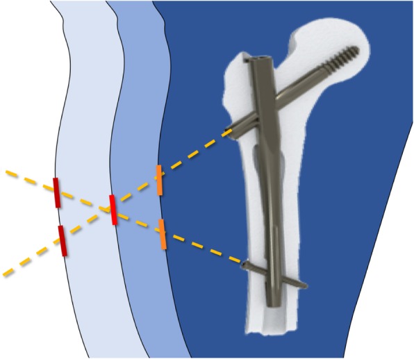 Fig. 2