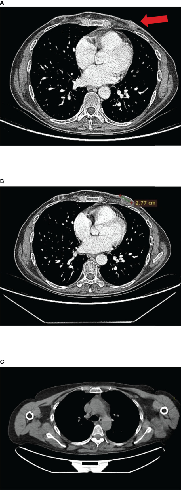 Figure 4