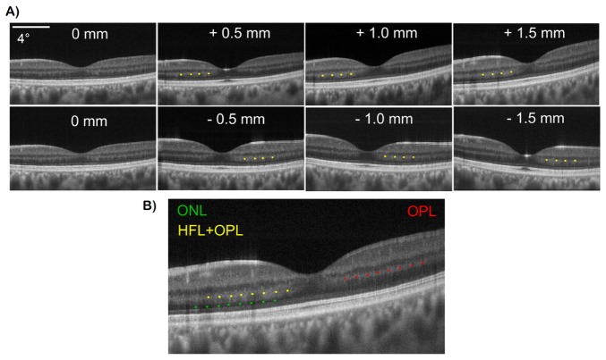 Fig. 9