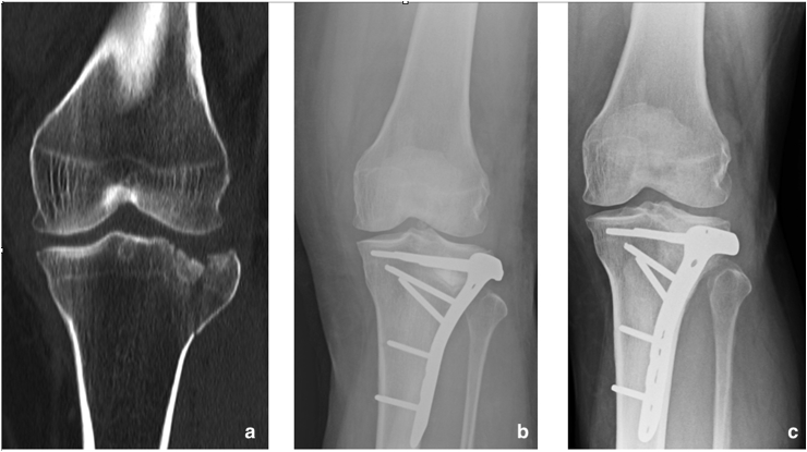 Fig. 2