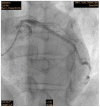 Fig. (2)