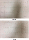 Fig. (1)