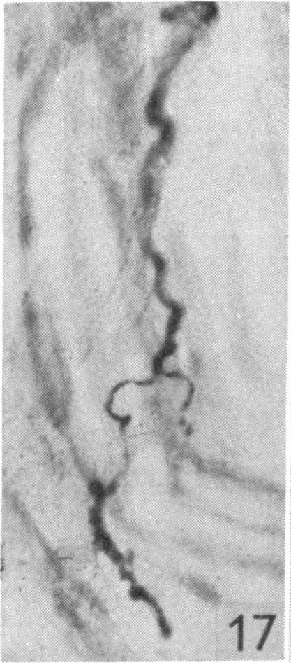 Fig. 17