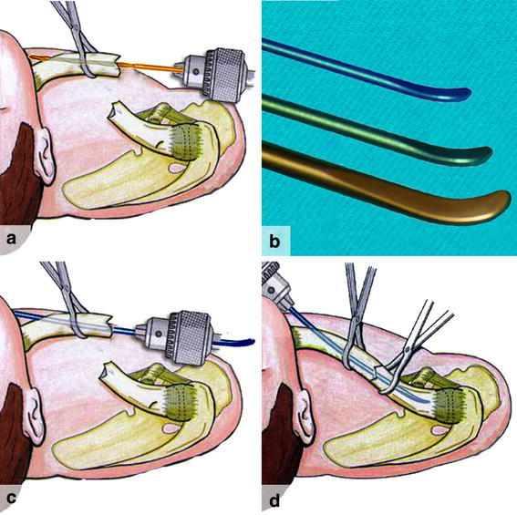 Fig. 1