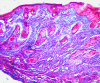 Fig. 12.