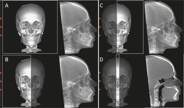 Figure 1 -