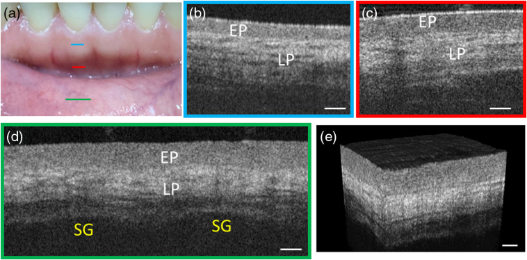 Fig. 4