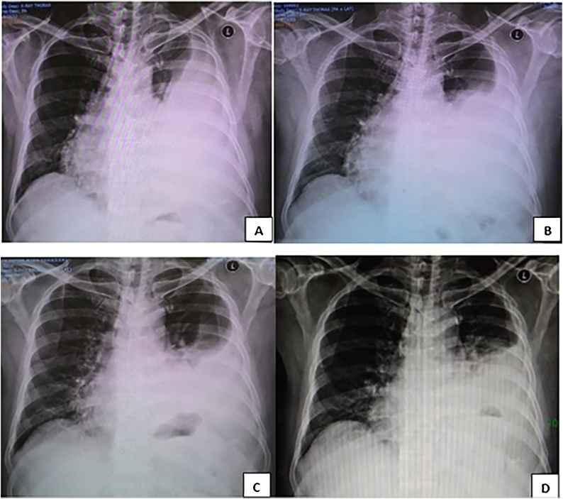 Fig. 4