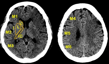 Fig. 3