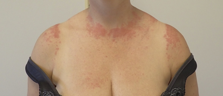 Fig 4