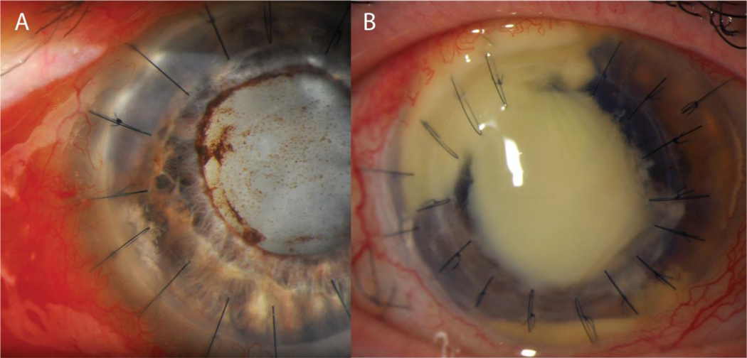 Figure 3: