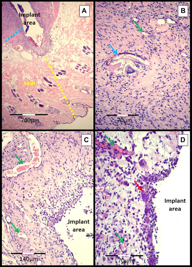 Fig 3.