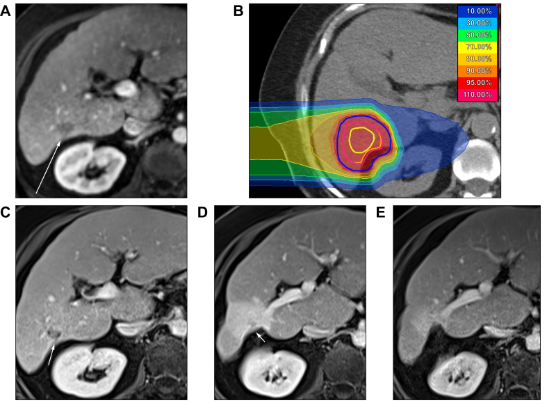 Fig. 2