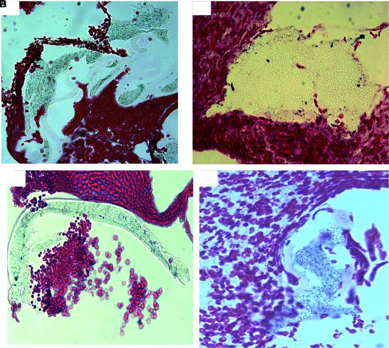 FIG 3.