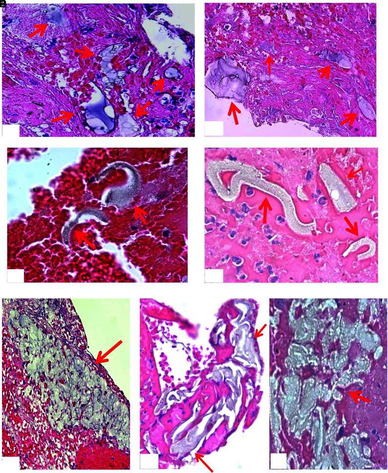 FIG 6.