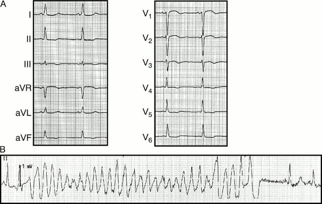 Figure 1  