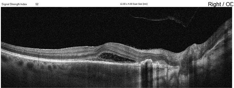 Figure 11