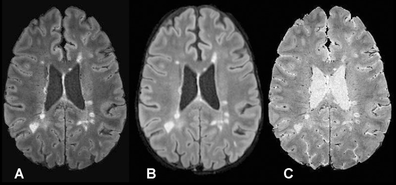 Figure 1: