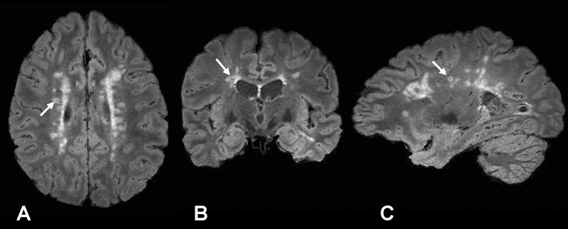 Figure 2: