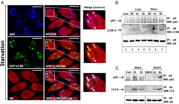 p62- and ubiquitin-dependent stress-induced autophagy of the mammalian ...