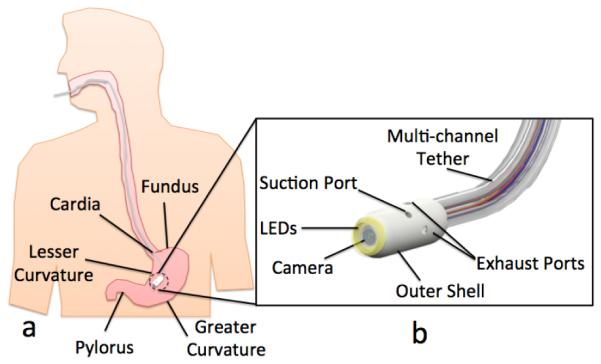 Fig. 1